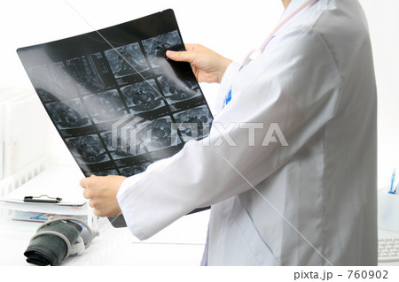「医療イメージ　レントゲン写真を診断する女医」の写真素材