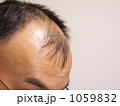 薄毛の悩みー３