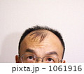 薄毛の悩みー６