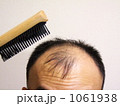 薄毛の悩みー８