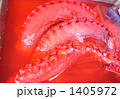 1405972