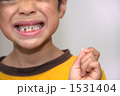 生え変わり