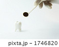 歯の検査