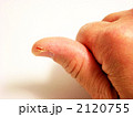 ひび割れた親指