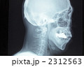 頭蓋骨