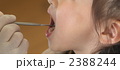 歯の検査