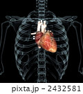2432581