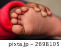 赤ちゃんの足の裏