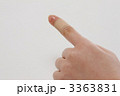 指に怪我