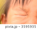 3595935