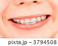 3794508
