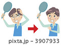 薄げ毛で悩む男性
