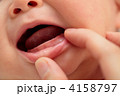歯が生える前の赤ちゃんの口