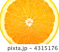4315176