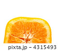 4315493