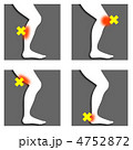 脚怪我B-3