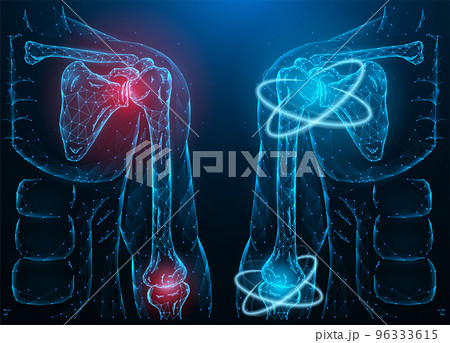 Polygonal Vector Illustration Of A Diseased Pixta