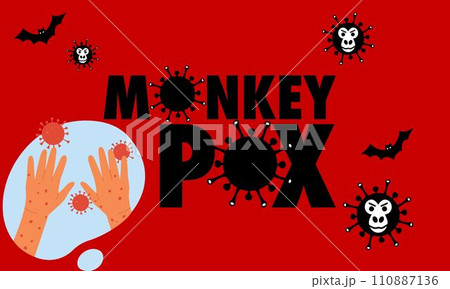 Monkeypox virus banner for awareness and alert のイラスト素材 110887136