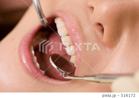 歯科治療イメージ 316172