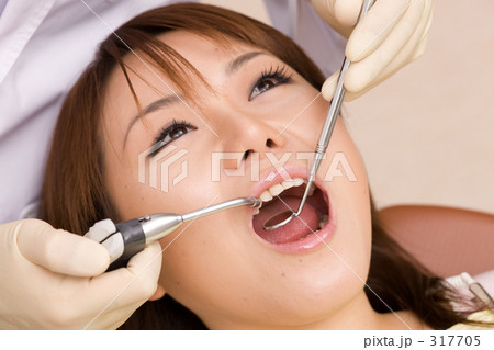 歯科治療イメージ 317705