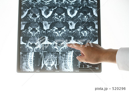 医療　MRI診断　６　部位を説明 520296