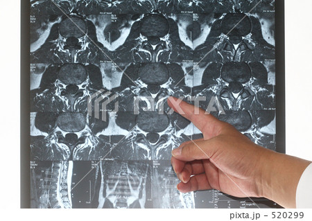 医療　MRI診断　３　ここです 520299