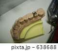 歯型 638688