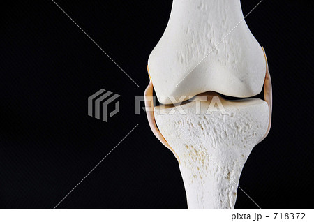 骨の模型（膝部） 718372
