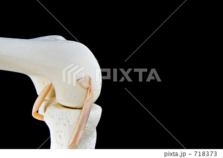 骨の模型（膝部） 718373