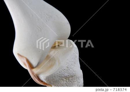 骨の模型（膝部） 718374