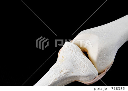 骨の模型（膝部） 718386