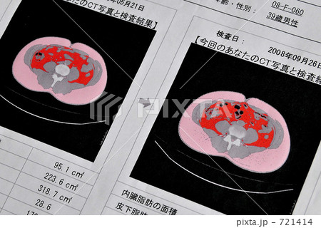 CT画像Ⅱ CT画像Ⅱ 721414