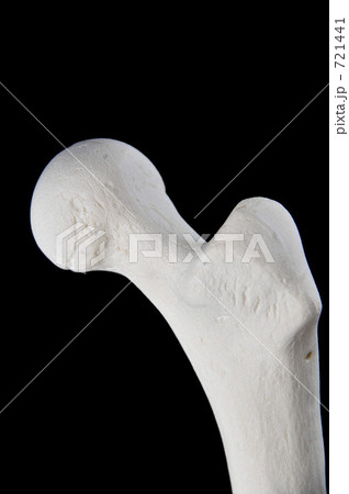 大腿骨模型Ⅹ 721441