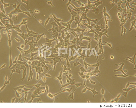 前立腺癌細胞株 821523
