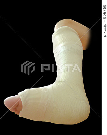 骨折でギプスを着けた足の裏 黒背景 906769