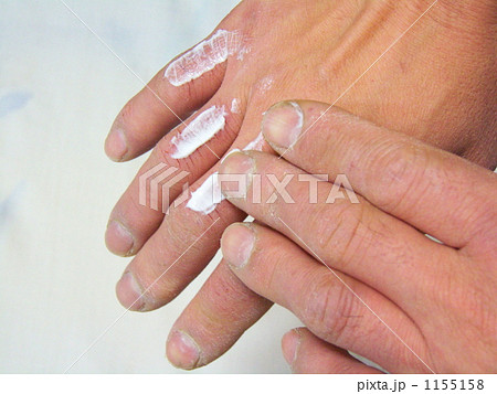 手荒れ防止ー３ 1155158