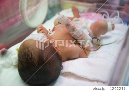 保育器 保育器 1202251