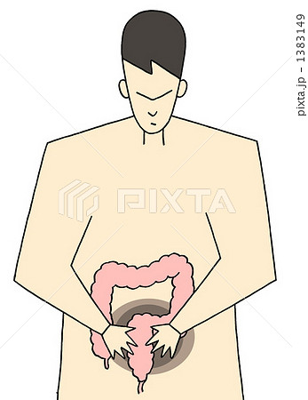 大腸疾患 1383149
