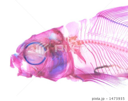 イェンツイ透明標本 イェンツイ透明標本 1473935