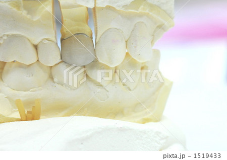 歯科技巧イメージ 1519433