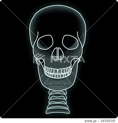 レントゲン写真のイラスト素材