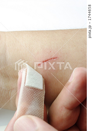 剥がしてみれば治りかけ 剥がしてみれば治りかけ 1744658