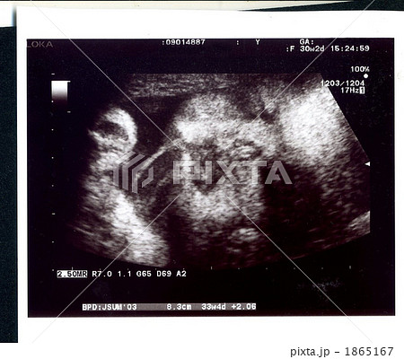 エコー写真 妊娠８カ月 顔の写真素材