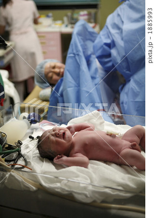 帝王切開での出産 1885993