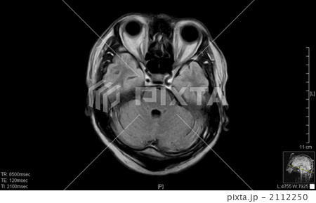 脳ドック 2112250