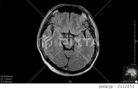 脳ドック 脳ドック 2112251