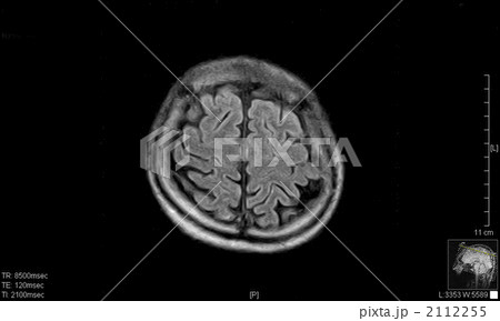脳ドック 脳ドック 2112255