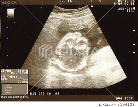 妊娠22週と5日の写真素材 妊娠22週と5日の写真素材