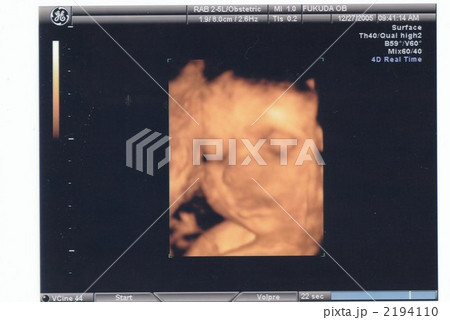 妊娠31週と4日 3dエコー写真の写真素材