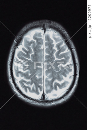 脳のMRI断層写真 2209972